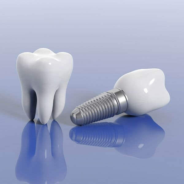 teeth whitening
