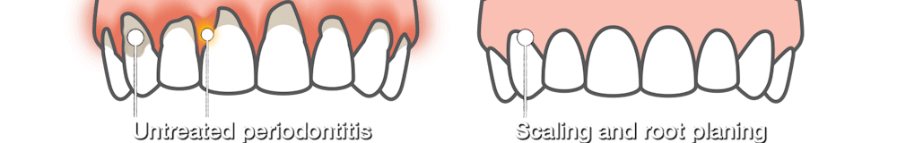 Dentist Carrollwood