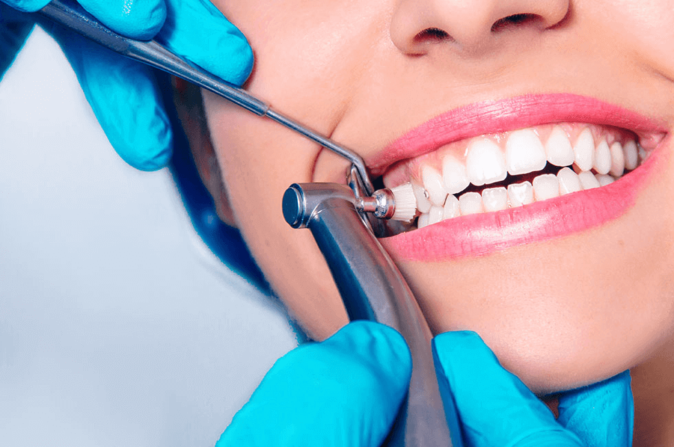 Benefits of Dental Cleaning