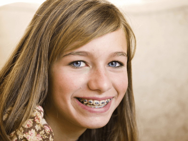 Braces For Teens