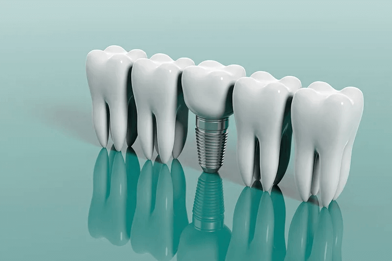 Endosteal Implants