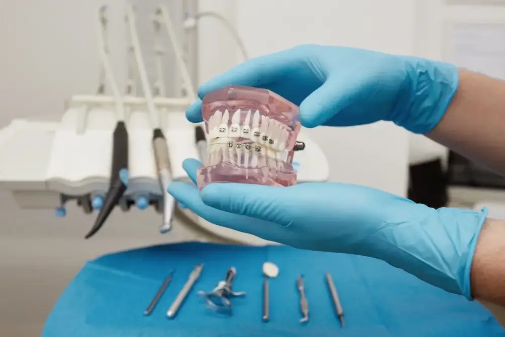 why teens need braces why teens need braces