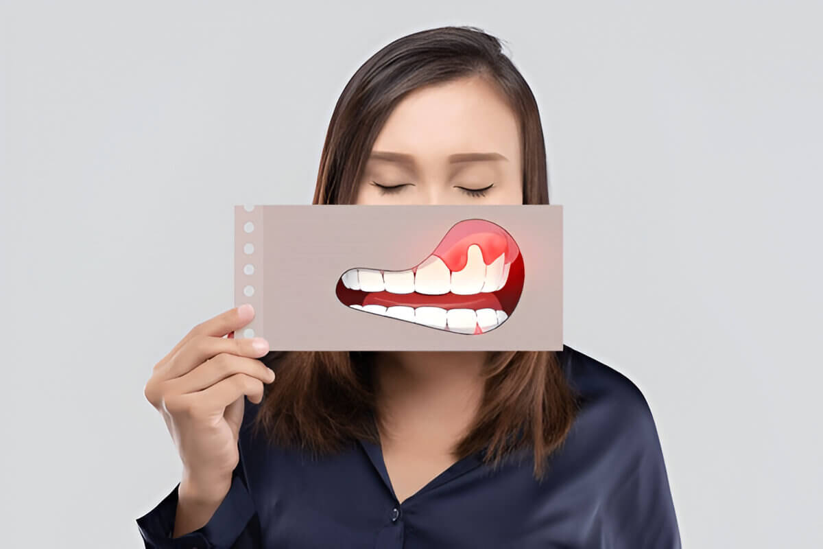 Gum Diseases Gum Diseases